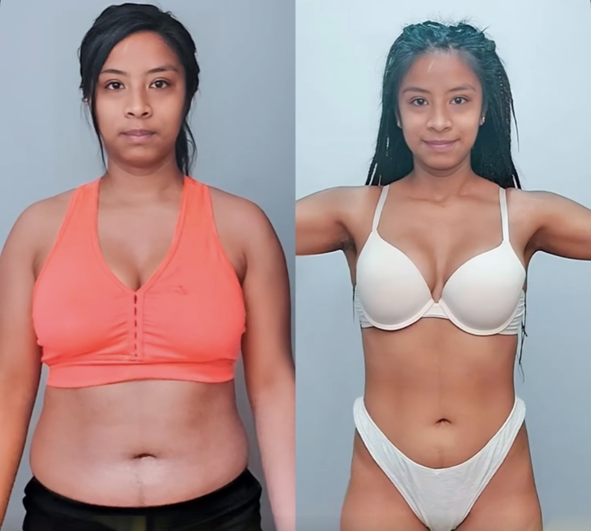 Transformación de Sofía L.